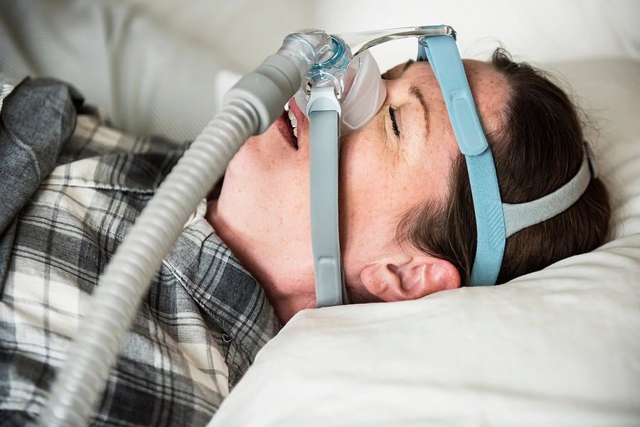 Female veteran with sleep apnea snoring with a CPAP mask indicating she qualifies for a VA disability rating